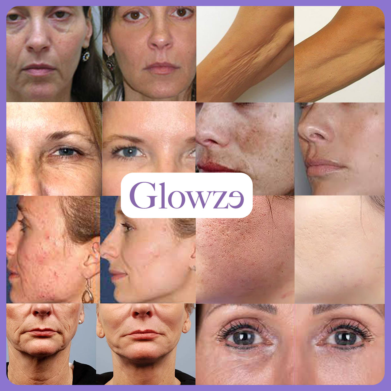 Skin Pulse Pro™